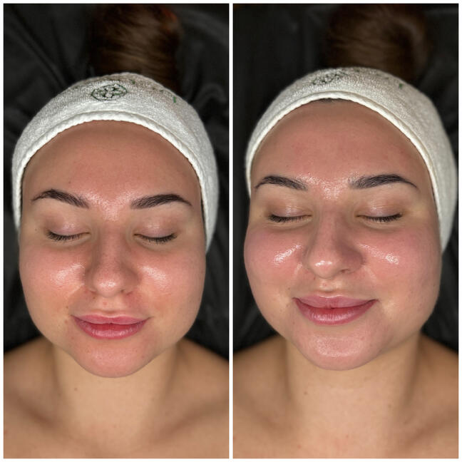 Hloubkové čištění BIOFOR